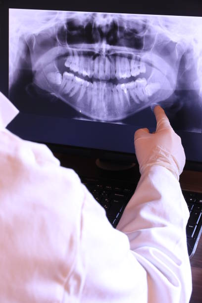 Best Emergency Treatment for Oral Infections in Kinder, LA