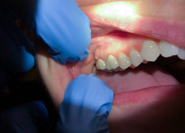 Trusted LA Emergency Dental Service Experts